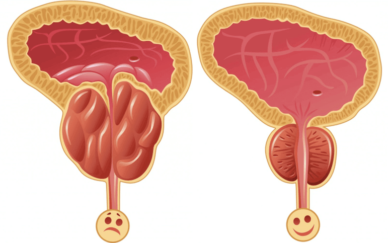 Causes of potency problems in men